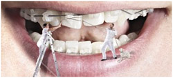 Ортодонтия – лечение аномалий зубочелюстной системы