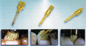 Торцевые щетки для стоматологического наконечника