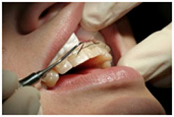 Лечение ортодонтических нарушений