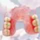 Съёмные нейлоновые гибкие зубные протезы Valplast (Валпласт) (на базе нейлона фирмы Valplast - США)