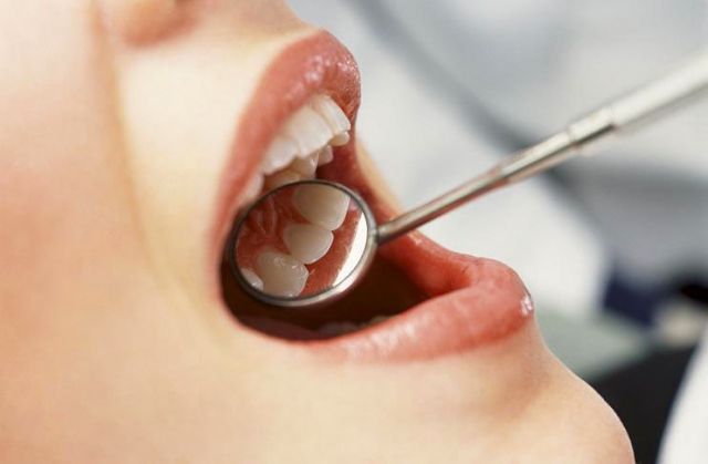 Что такое удаление зубного камня, выравнивание корня, кюретаж?