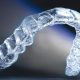 Что такое ортодонтическая система - каппы-элайнеры Инвизилайн (Invisalign)?