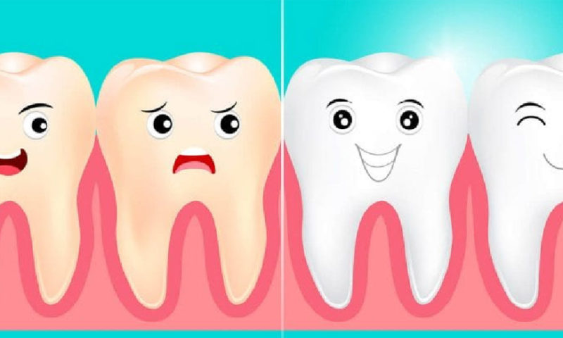 Как отбелить зубы во время карантина?