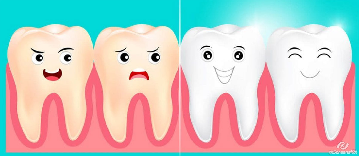 ТОП 8 способов отбеливания зубов с использованием соды